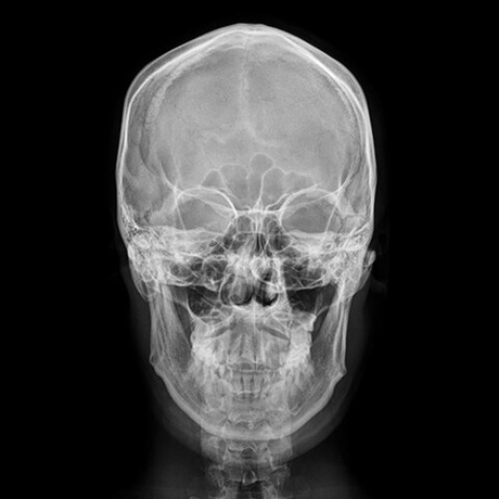 Альбом Coogie - UPSET