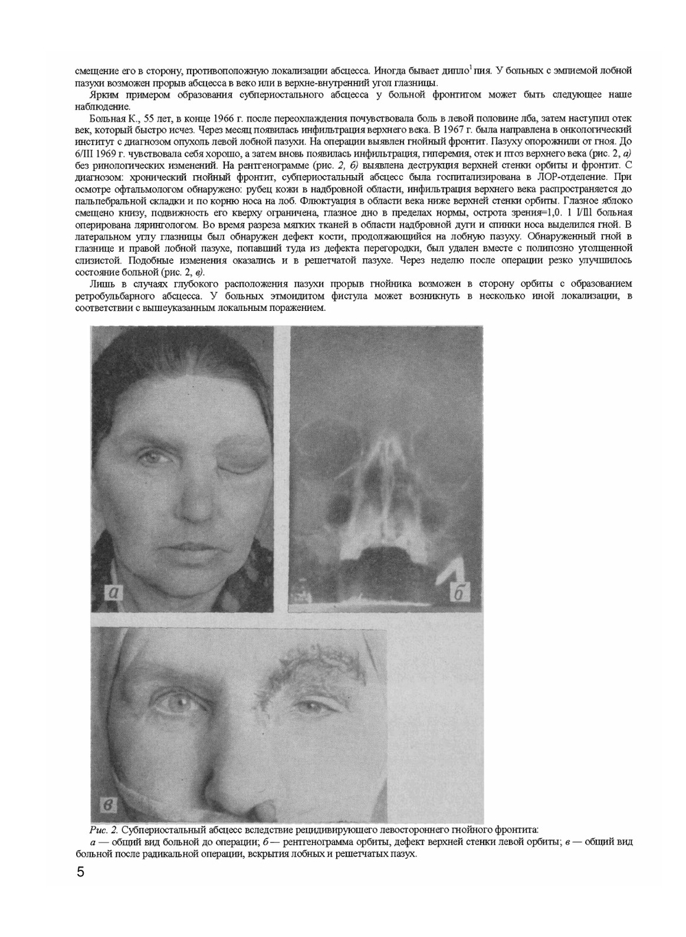 Офтальмологические симптомы при болезнях ЛОР-органов и полости рта | М.М. Золотарева