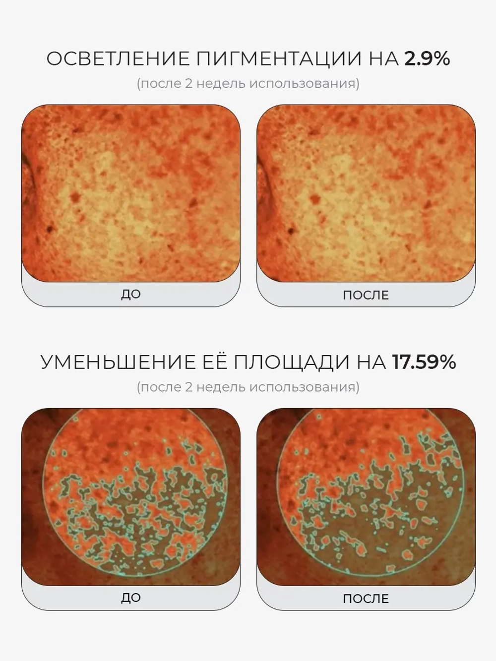 Medicube Сыворотка с микроиглами, ПДРН и экзосомами против пигментации PDRN Pink Collagen Exosome Shot 2000 30 мл