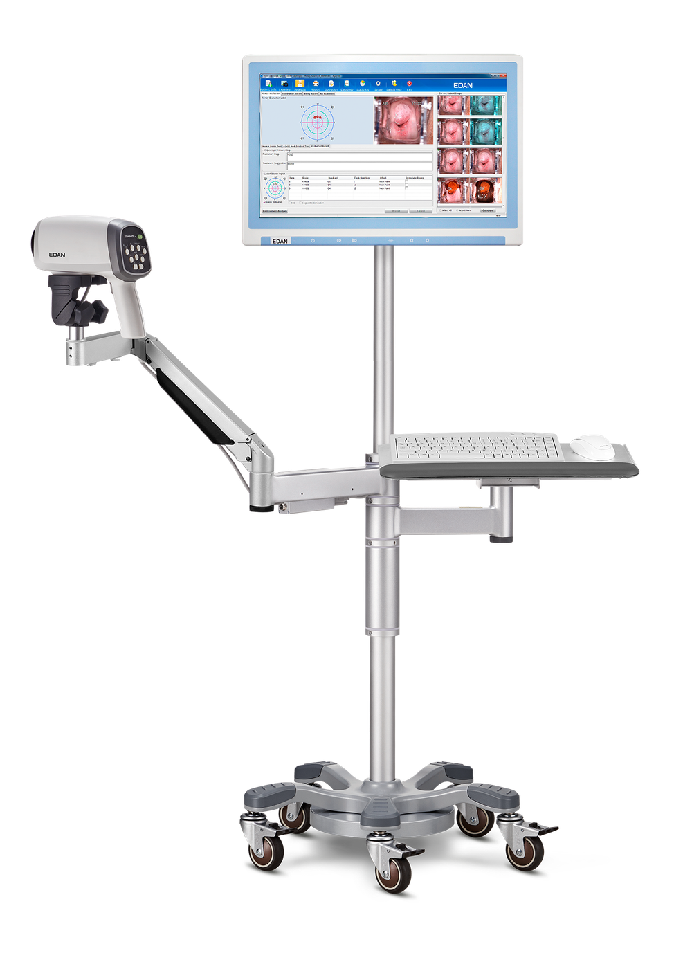 Видеокольпоскоп Edan C6 и Edan C6A