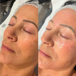 Rejusome | Сыворотка для омоложения кожи лица с экзосомами