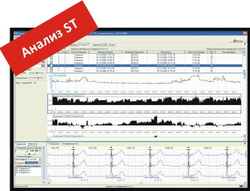 Монитор холтеровский ЭКГ Кардиан КР-01 с ПО