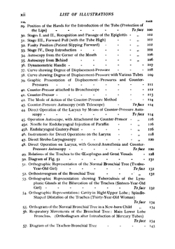 Direct laryngoscopy, bronchoscopy, and oesophagoscopy | Wilhelm Brünings