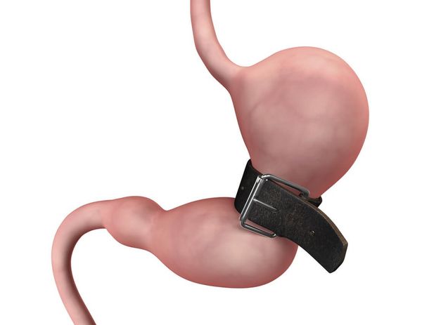 Доктор, отрежьте мне….диабет…