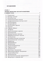 Лучевая диагностика опухолей и опухолевидных заболеваний позвоночника и спинного мозга