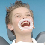 Optragate Junior (Детский) (10 шт.) Оптрагейт, ретрактор для губ, роторасширитель