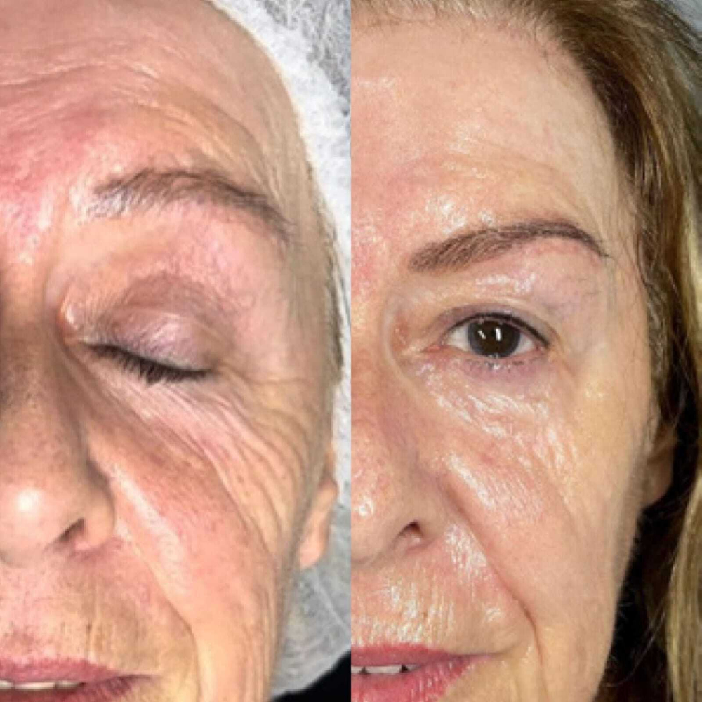 Rejusome | Сыворотка для омоложения кожи лица с экзосомами