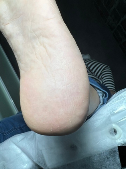 Педикюр smart