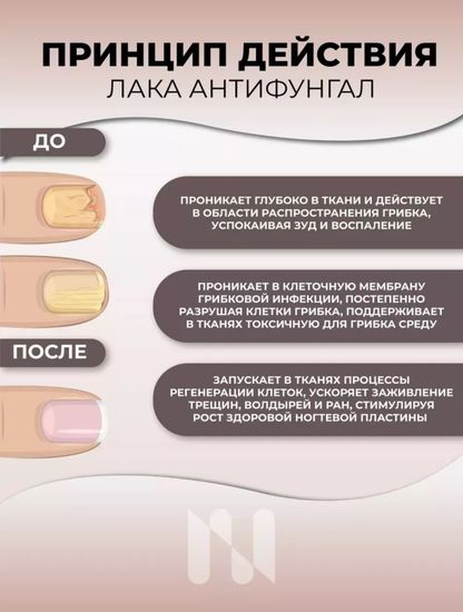 Лак противогрибковый BASIC антифунгал, 11 мл Masura