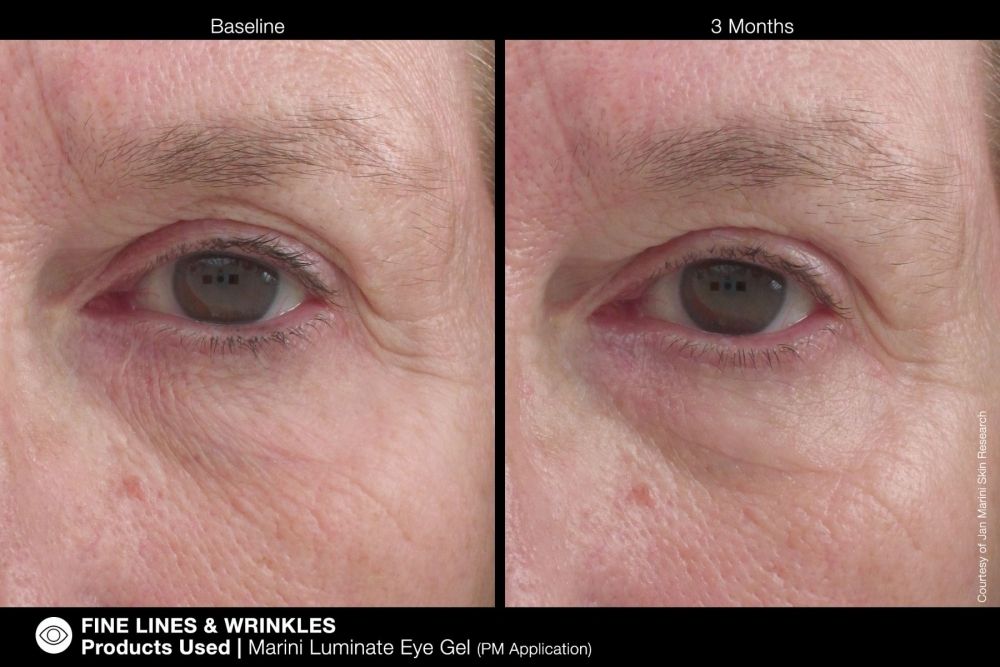 Jan Marini MARINI LUMINATE® EYE GEL Концентрированная сыворотка для кожи вокруг глаз с эффектом сияния против темных кругов и морщин.  Объем: 15 мл.