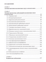 Лучевая диагностика заболеваний околоносовых пазух и полости носа. 4-е издание
