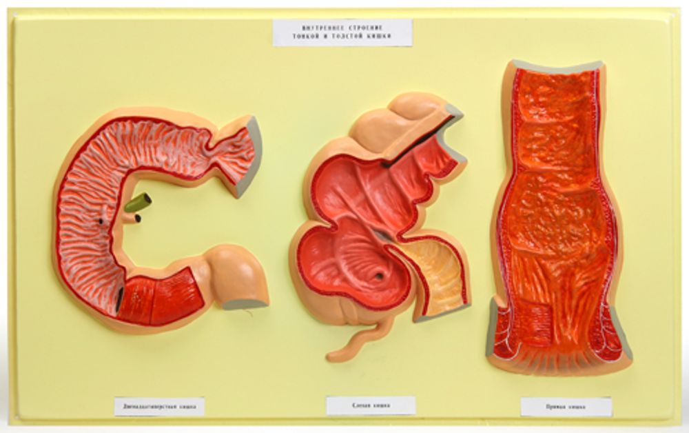 Барельефная модель &quot;Внутренняя поверхность тонкой и толстой кишки&quot;