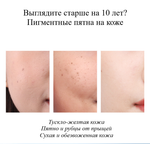 Маска с никотинамидом Venzen Whitening and freckle Nicotinamide Осветляющая 25 г