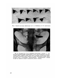 Атлас гистеросальпингографии | М.М. Абрамова