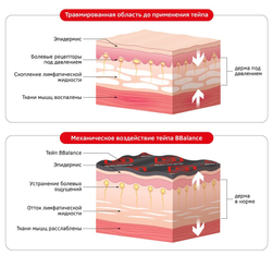 Кинезио тейп BBTape 5см*5м MAX
