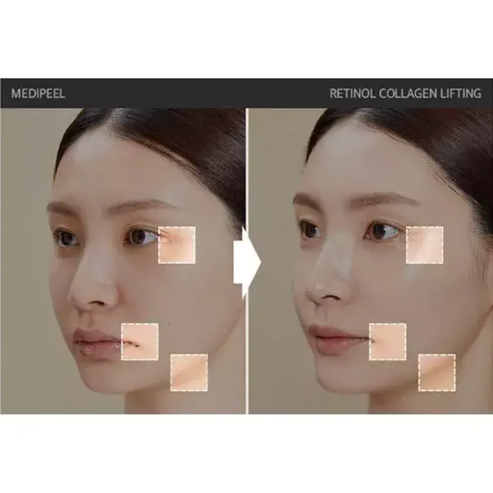 MEDI-PEEL Лифтинг-ампула для лица с ретинолом и коллагеном Retinol Collagen Lifting Ampoule (50мл.)