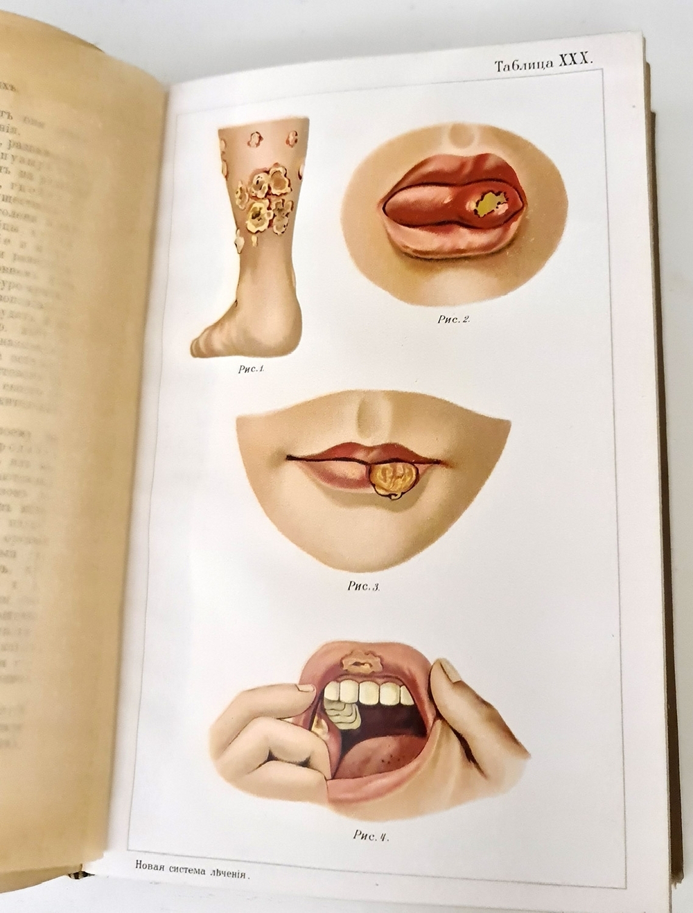 "Новый способ лечения. Настольная книга для здоровых и больных". Платен М.