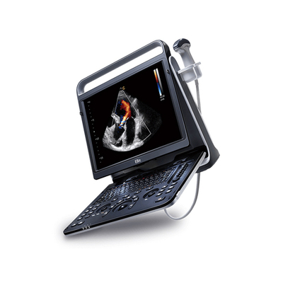 Ультразвуковой аппарат Chison SonoTouch 60