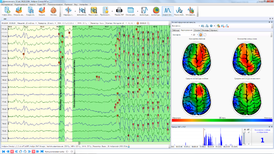 НЕЙРОН-СПЕКТР-4/П