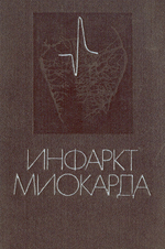 Инфаркт миокарда