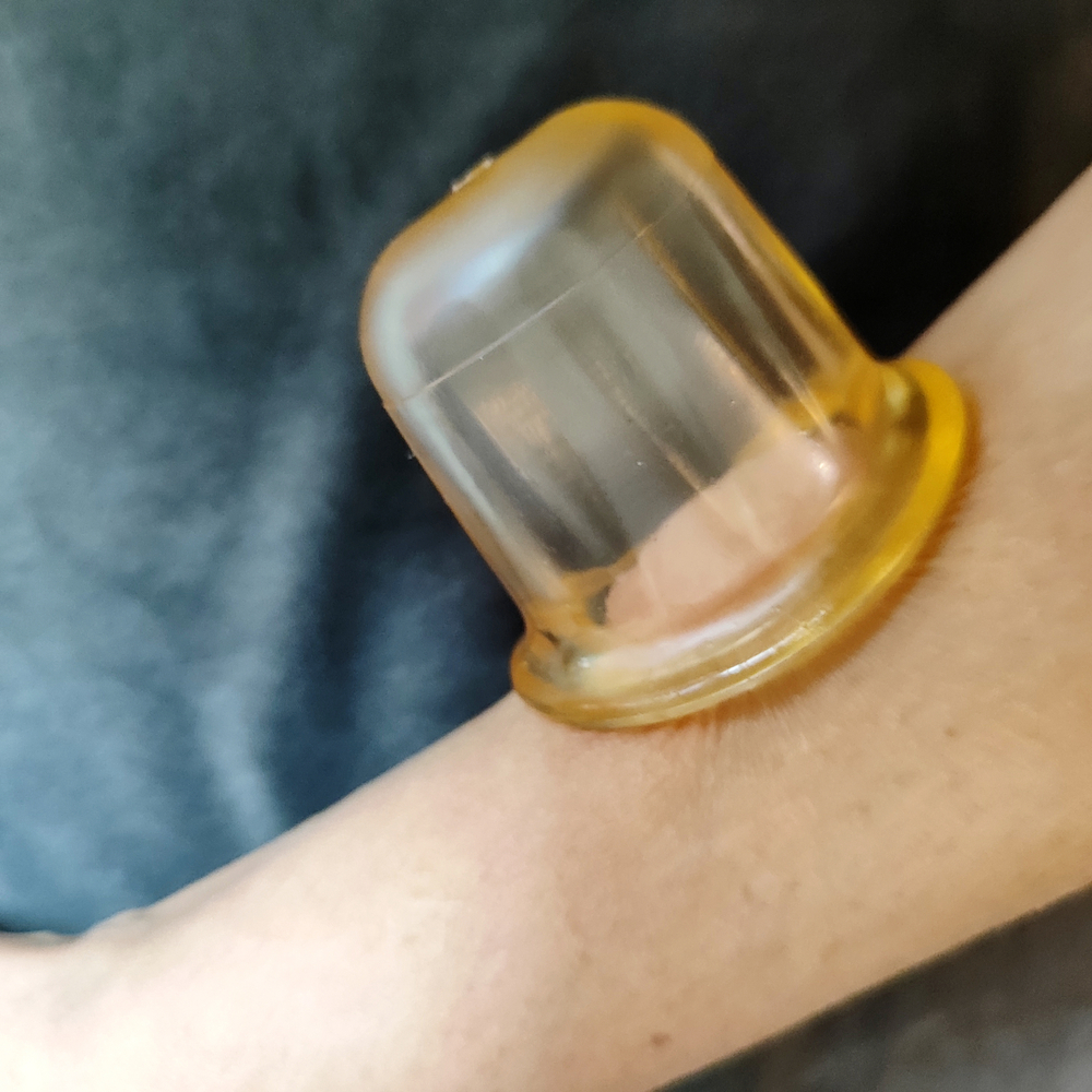 Вакуумная банка для суставов полимерная