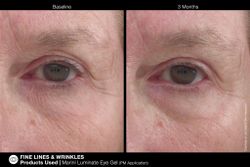 JAN MARINI LUMINATE EYE GEL Концентрированная сыворотка для кожи вокруг глаз с эффектом сияния против темных кругов и морщин