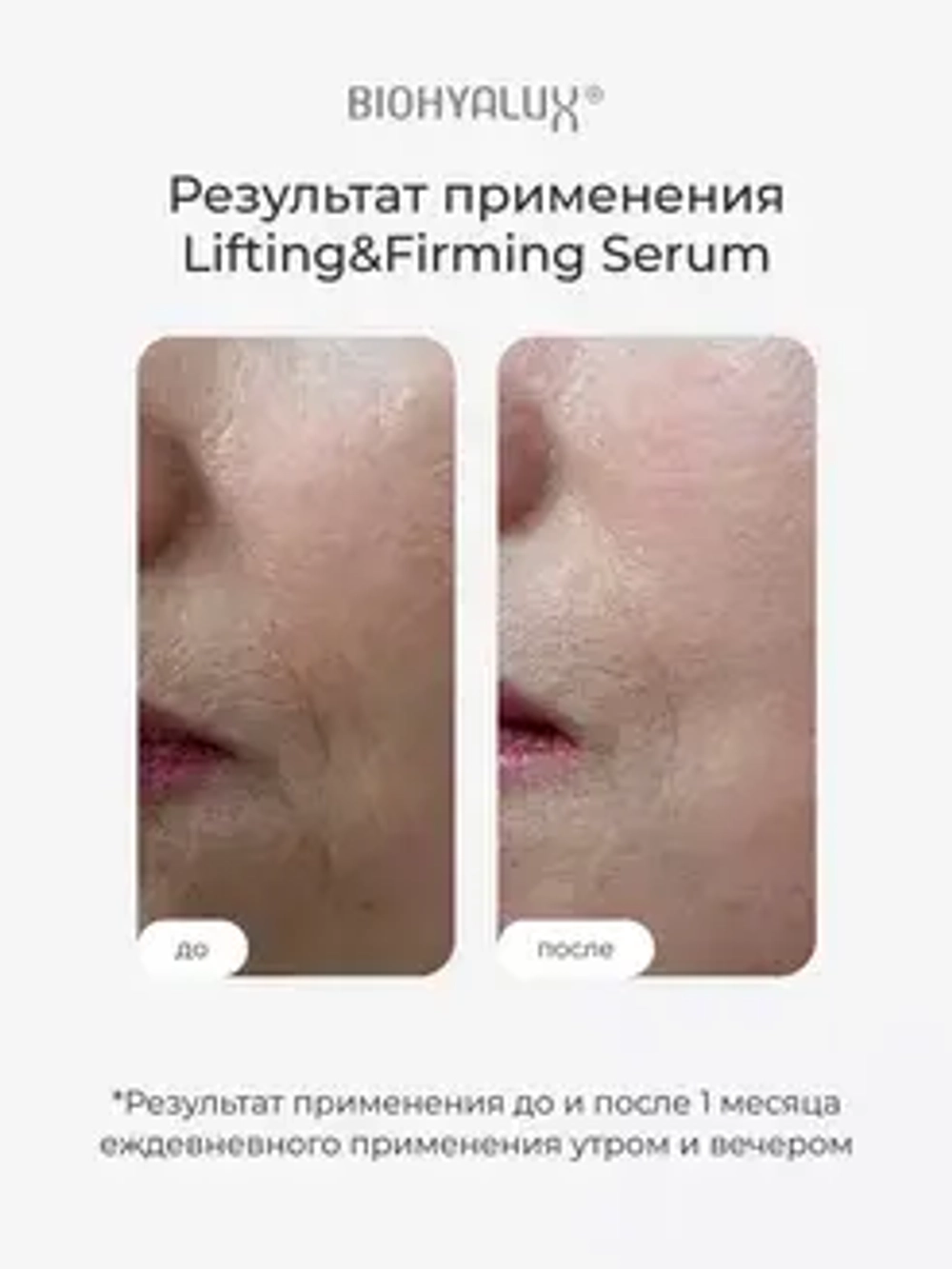 Сыворотка с гиалуроновой кислотой для повышения упругости и лифтинга кожи | BIOHYALUX HА LIFTING&FIRMING SERUM 30х1,5 мл