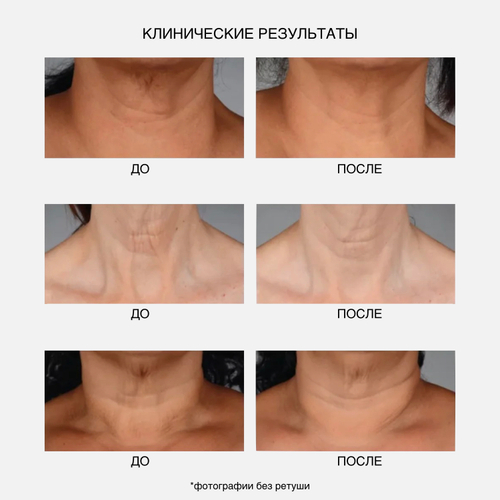 IS CLINICAL NeckPerfect Complex Интенсивный anti-age крем для шеи, 50 мл