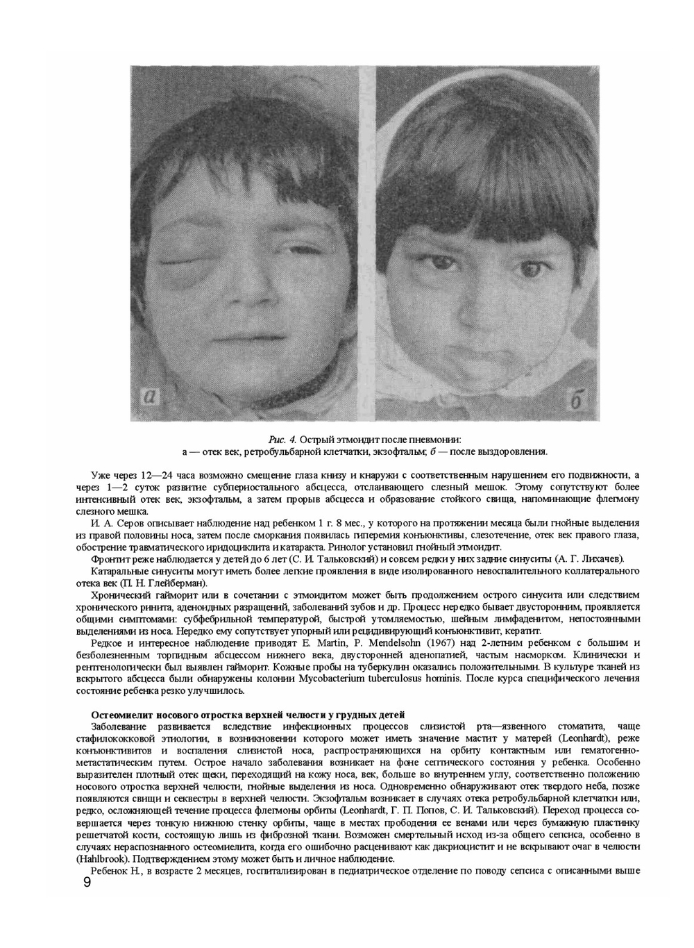 Офтальмологические симптомы при болезнях ЛОР-органов и полости рта | М.М. Золотарева