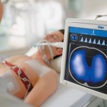 Dr_ger PulmoVista 500 Система электроимпедансной визуализации легких