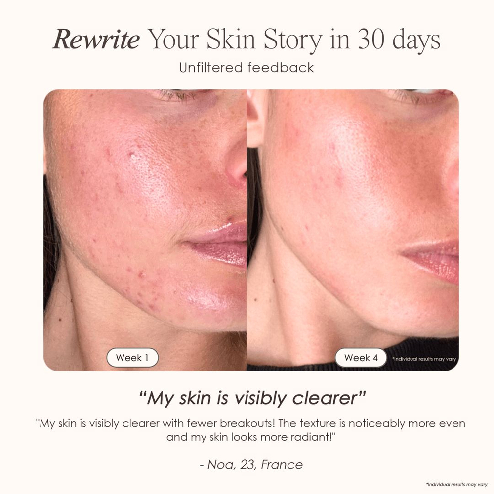 Project E Beauty Маска для светодиодной терапии красным светом LumaLux Face Pro LED Red Light Therapy Mask