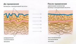 Коллаген говяжий (MegaProtein)