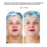 Biotime BIOMATRIX PROBIO PEEL биоматрикс пробио пил Всесезонный. Глубоко увлажняющий. Омолаживающий. 30мл