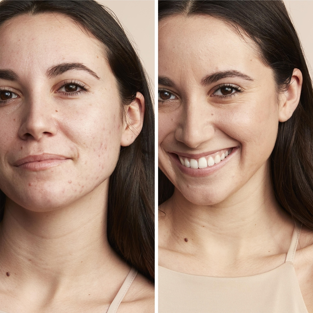 Avene Couvrance Compact Cream Foundation - Кремовый тональный крем с высокой степенью защиты от ультрафиолета, 8,5 g