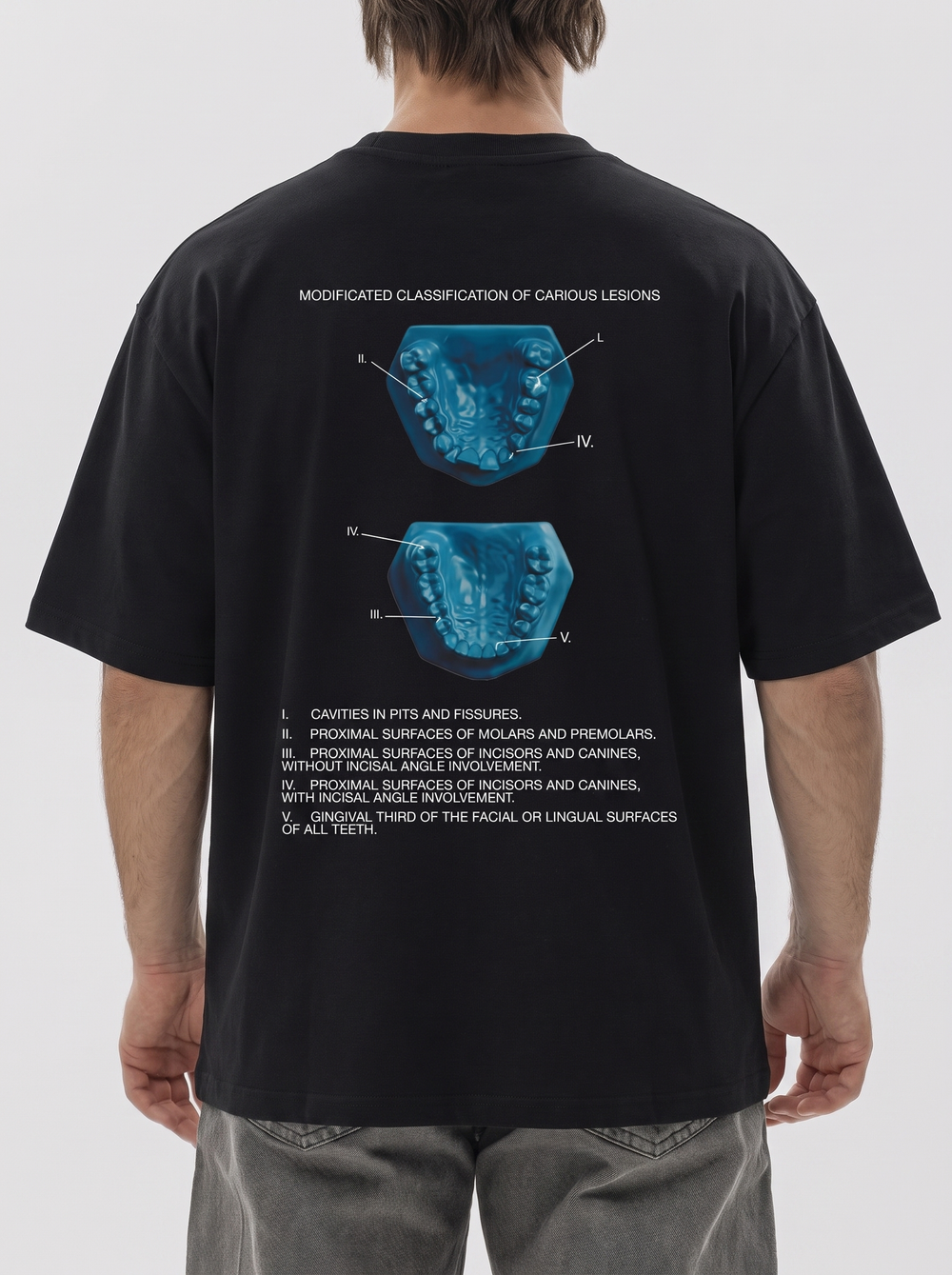 Футболка мужская Modified classification of caries