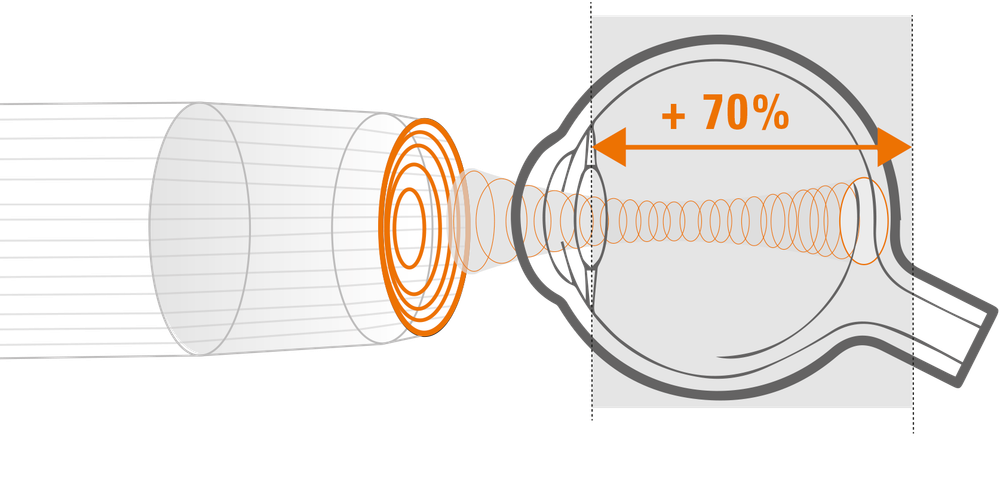 Офтальмологический ультразвуковой диагностический прибор ABSOLU