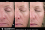 JAN MARINI AGE INTERVENTION RETINOL PLUS MD 1% Крем-акселератор с ретинолом 1% для борьбы с видимыми возрастными изменениями