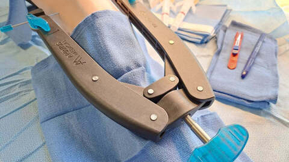 От концепции до коммерциализации за четыре месяца: Как Arbutus Medical использовала 3D-печать для быстрой разработки устройств