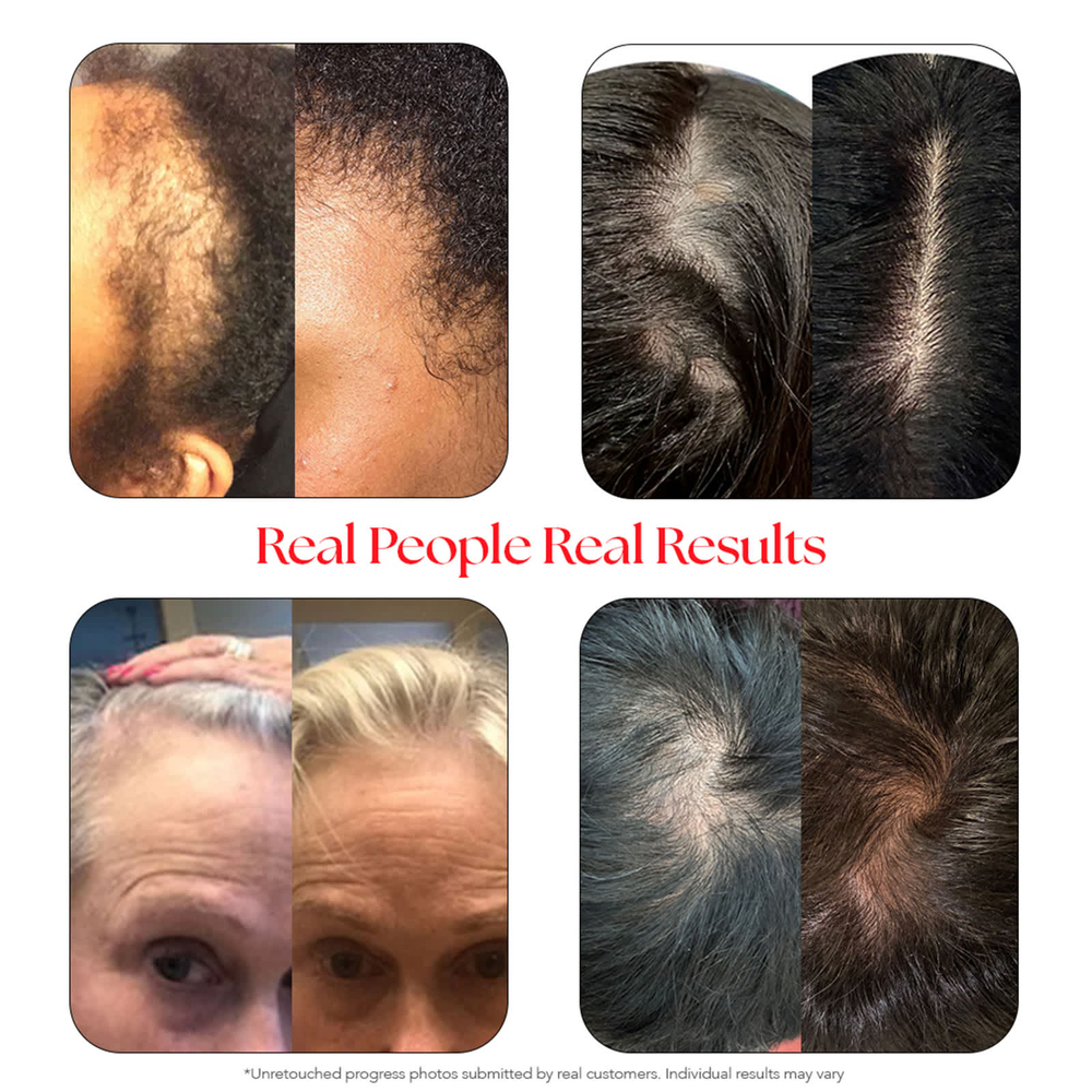 HAIRtamin, Сыворотка для кожи головы, 60 мл (2 жидк. Унции)