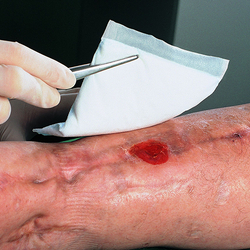 Повязка Фливацель (Vliwazell)10х10см, 60шт стерильная