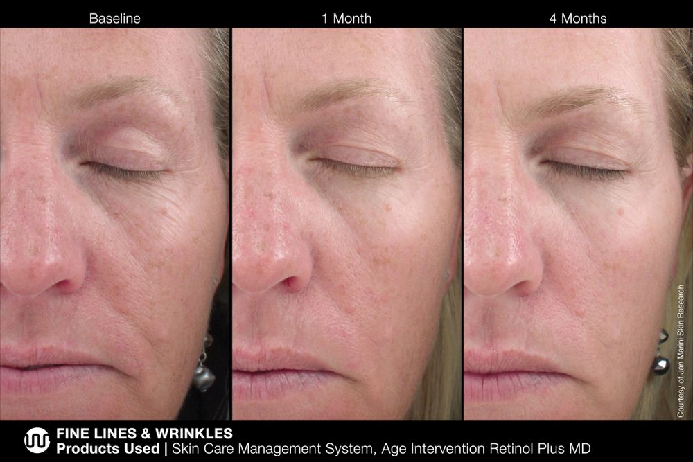 JAN MARINI AGE INTERVENTION RETINOL PLUS MD 1% Крем-акселератор с ретинолом 1% для борьбы с видимыми возрастными изменениями