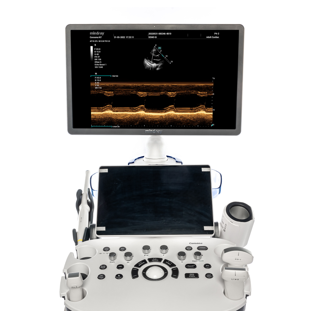 Ультразвуковая система Mindray Consona N7Q