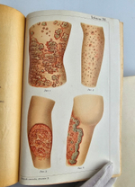 "Новый способ лечения. Лечение целебными силами природы."  М. Платен. 1906 г.