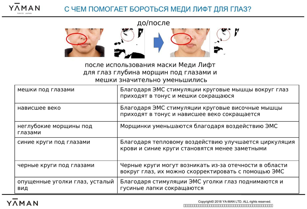 YA-MAN Medi Lift Eye. Электрический микротоковый массажер для лица.