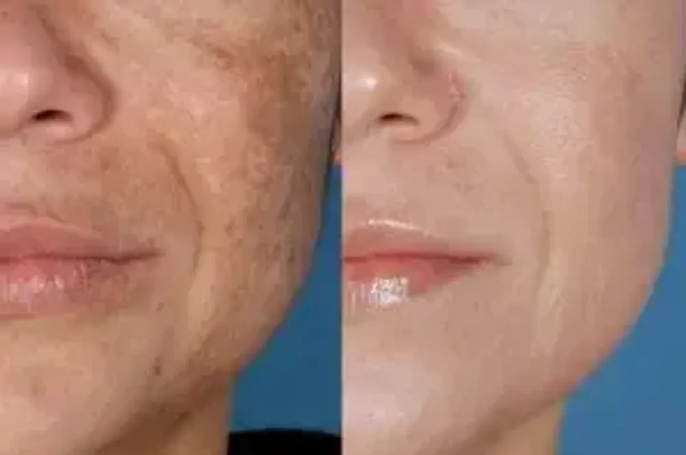 Веганский пилинг-тоник с 7% гликолевой кислоты The Ordinary Glycolic Acid 7% Exfoliating Toner 240 мл.