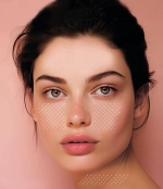 Ultracol 100 Ultra V | Стимуляция синтеза коллагена с Полидиоксаноном (PDO)