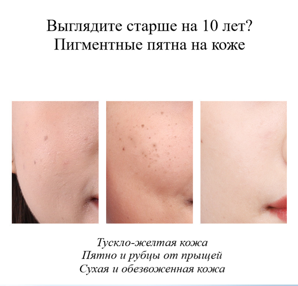 Маска с никотинамидом Venzen Whitening and freckle Nicotinamide Осветляющая 25 г