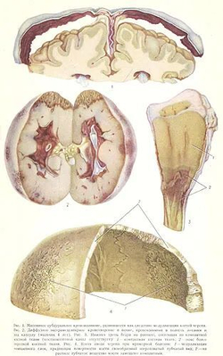 Большая медицинская энциклопедия. В 35-ти томах + дополнительный том (комплект из 36-ти книг)