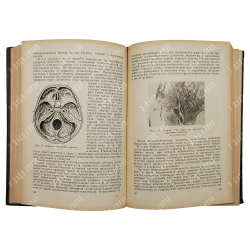 Циммерман Г. С. Клиническая отоневрология, 1952.