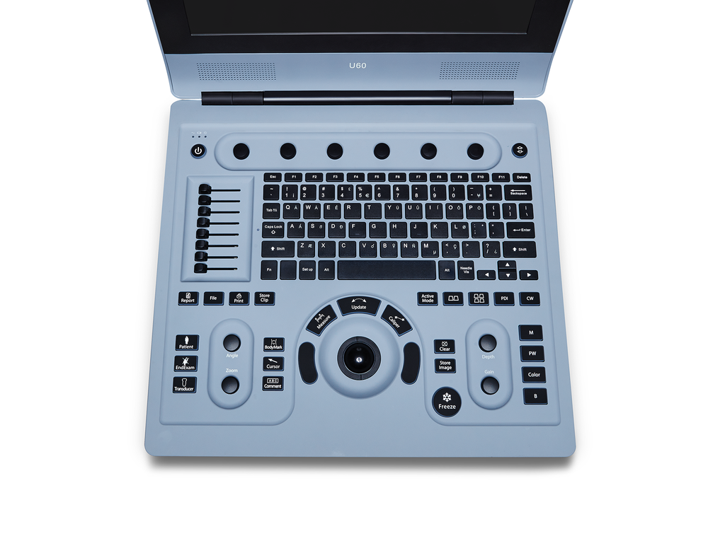 УЗИ аппарат Edan U60